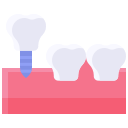 implante dental 