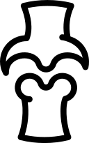 osteoartritis 