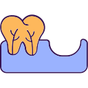 Weak tooth 