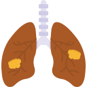 bronquitis 