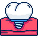 implant dentaire 