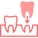 implantes icon