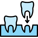 implantes icon