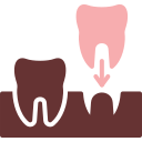 Implants 