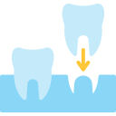 implantes icon