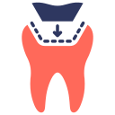 relleno de dientes 