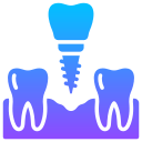 implante dental 