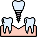 implante dental 