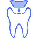 relleno de dientes 