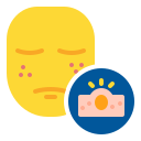 acné 