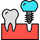 implantes icon