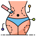 liposuccion 