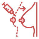 Breast augmentation 