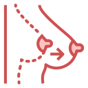 Breast augmentation 