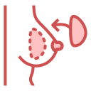 implant mammaire 
