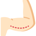 Braquioplastia