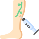 Sclerotherapy 