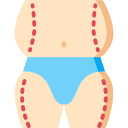 지방 흡입술 
