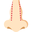 Rinoplastia 