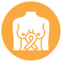 Breast cancer 