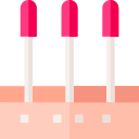 Иглоукалывание