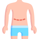 abdominoplastia