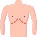 abdominoplastia 