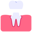 corona dental 