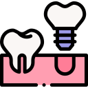 implante dentário 