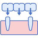 implante dental 