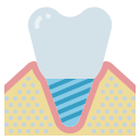implant dentaire 