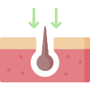 transplante de pelo 