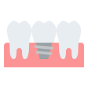 implante dentário 