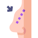 rinoplastia 
