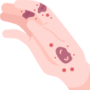 dermatitis icon