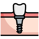 implante dental icon