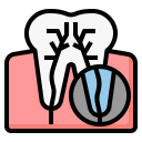 Root canal 