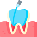 Root canal 