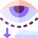 blefaroplastia 