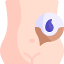 Depilation 