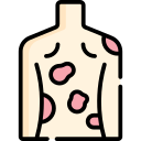 urticaria icon