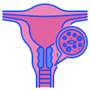 cáncer de cuello uterino