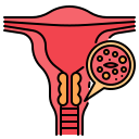 cáncer de cuello uterino