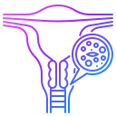 cáncer de cuello uterino 