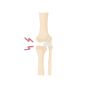 articulación de la rodilla 