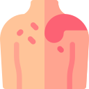 cáncer de piel icon