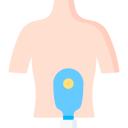 colostomía