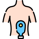 colostomía