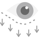 Blefaroplastia 