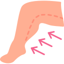 지방 흡입 
